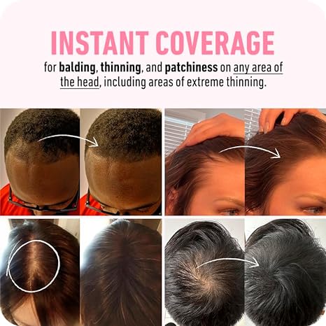 🎉 Magic Root Cover Up-Buy 1 Get 1 FREE!